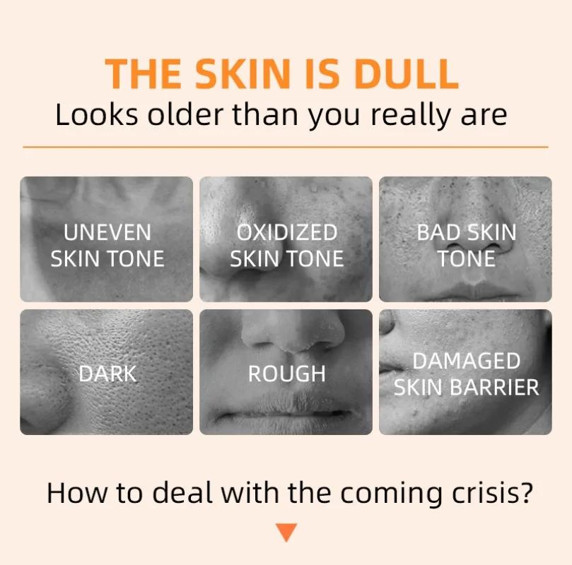 Orange Exfoliating Gel Dead Spot Remover Brighten Peeling 50g Gentle Repair Scrub Whiten Hydrating Moisturizer Korean Skin Care Orange Exfoliating Gel Dead Spot Remover Brighten Peeling 50g Gentle Repair Scrub Whiten Hydrating Moisturizer Korean Skin Care