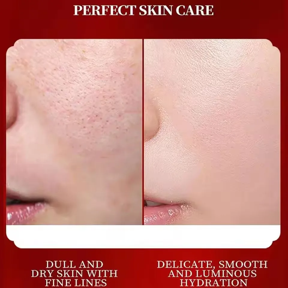 Dragon Blood Retinol Cream Moisturizer Facial Cream Improve Dry And Rough Skin Korean Cosmetics For Face Cream Skin Care Dragon Blood Retinol Cream Moisturizer Facial Cream Improve Dry And Rough Skin Korean Cosmetics For Face Cream Skin Care