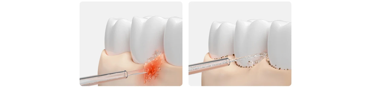 XIAOMI MIJIA Portable Oral Irrigator,Four Modes,1400 Time/m Water Spray,200ML Water Tank,Irrigator Dental Water Flosser Pick Jet XIAOMI MIJIA Portable Oral Irrigator,Four Modes,1400 Time/m Water Spray,200ML Water Tank,Irrigator Dental Water Flosser Pick Jet